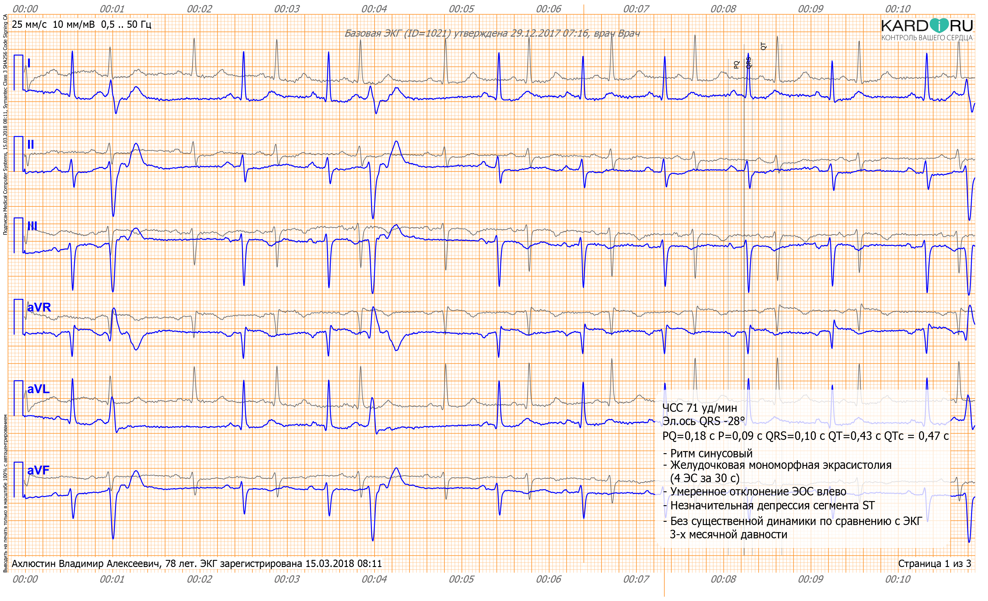 KardiRuConclusion-ECG-1.png